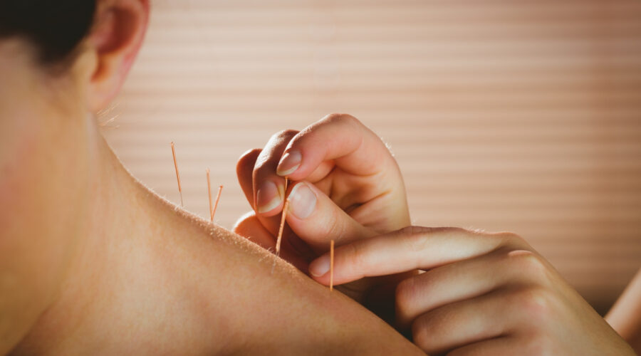 L’acupuncture moderne : entre tradition millénaire et science contemporaine