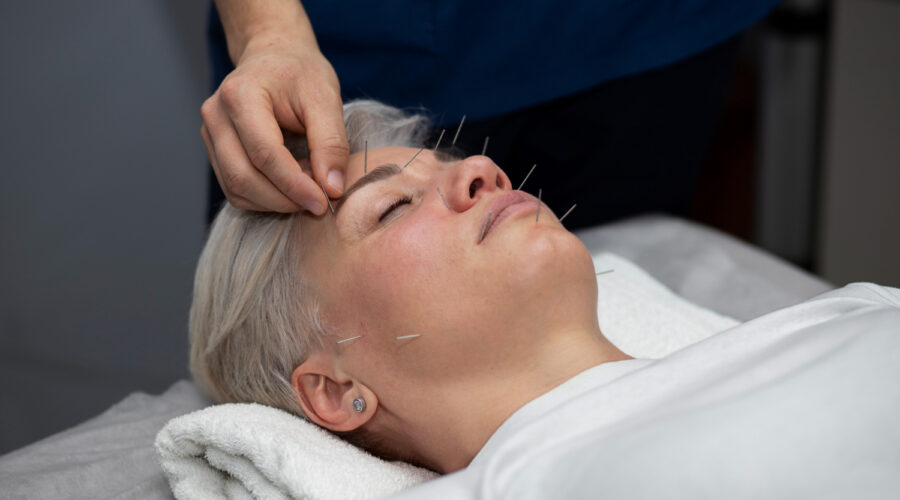 Les 10 bienfaits prouvés de l’acupuncture sur le corps et l’esprit